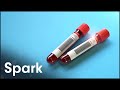Is Synthetic Blood A Viable Alternative?