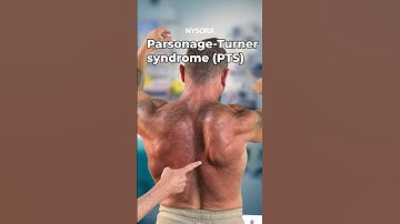 Parsonage-Turner Syndrome #parsonage #turner #syndrome #scapular #winging #nerve #injury