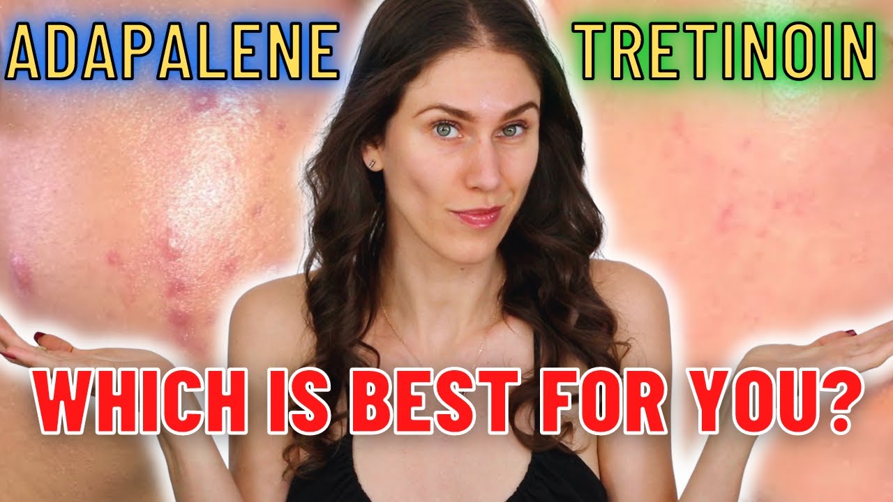 ⁣Adapalene vs Tretinoin - Which Is The Best ANTI-ACNE and ANTI-AGING Ingredient?