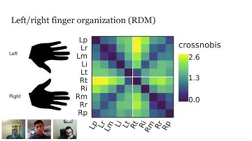 Charles Guan : Decoding finger movements from human posterior parietal cortex...