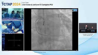 [TCTAP 2024] Live Case & Lecture 6: Complex PCI