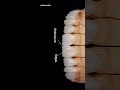 Full mouth smile make over via emax custom veneers Call us today to schedule your consultation!