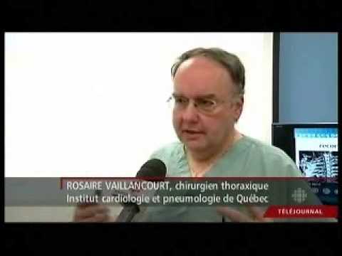 Vidéo: Fractures Multiples Des Côtes