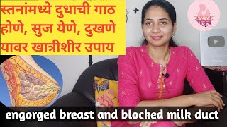 स्तनांमध्ये दुधाची गाठ होणे सुज येणे दुखणे यावर उपाय | Engorged breast and blocked milk duct marathi