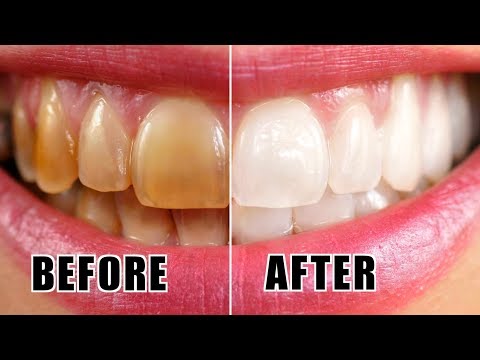 10 HACKS TO