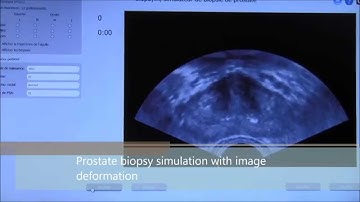 3D interactive ultrasound image deformation for realistic prostate biopsy simulation