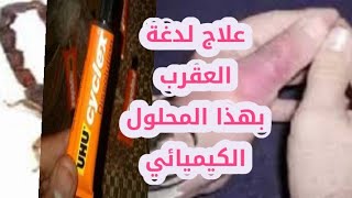 علاج لدغة العقرب بهذه المادة الكيميائية الرخيصة والفعالة جدا