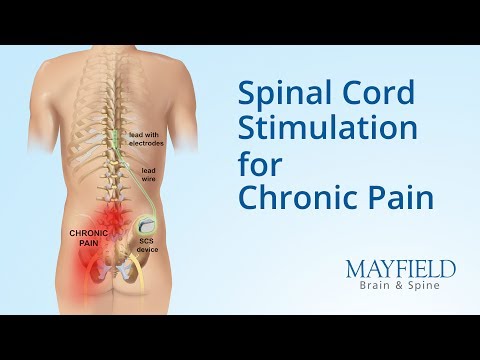 What causes back pain? And what treatments can help? - George Pan, MD | UCLA Pain Center. 