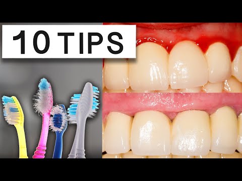 10 Tips To Reduce Swollen Gums At