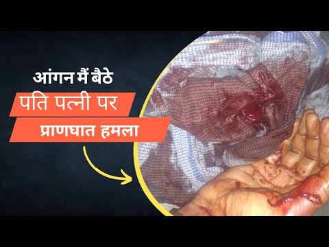 आंगन में बेटे पति-पत्नी पर एक युवक ने धारदार हथियार से किया प्राणघातक हमला