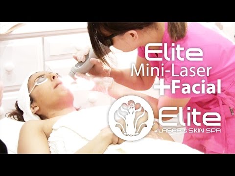 mini-laser-hair-removal-with-signature-facial-|-elite-laser-&-skin-spa-boston