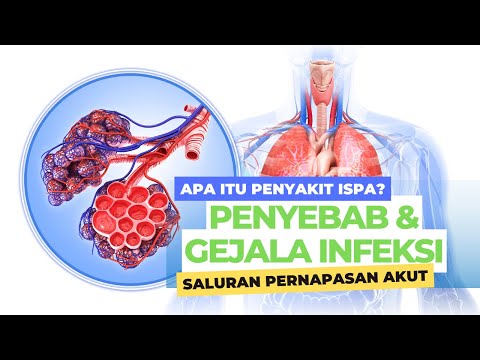 Apa Itu Penyakit ISPA Penyebab dan Gejala Infeksi Saluran Pernapasan Akut - SehatPedia