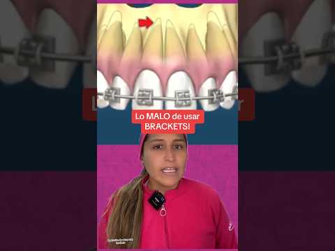 Al usar #brackets