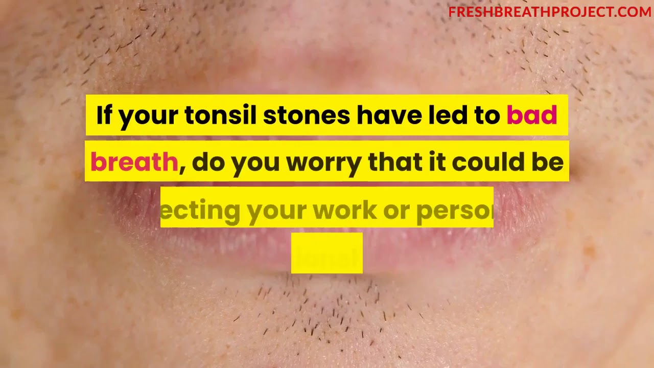 How To Get Rid Of Tonsil Stones At Home - YouTube