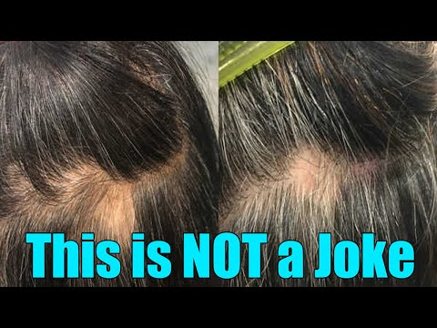 Turn White Hair Into Black Apply This And Turn White Hair To Black Naturally, Treatment forwhiteHair