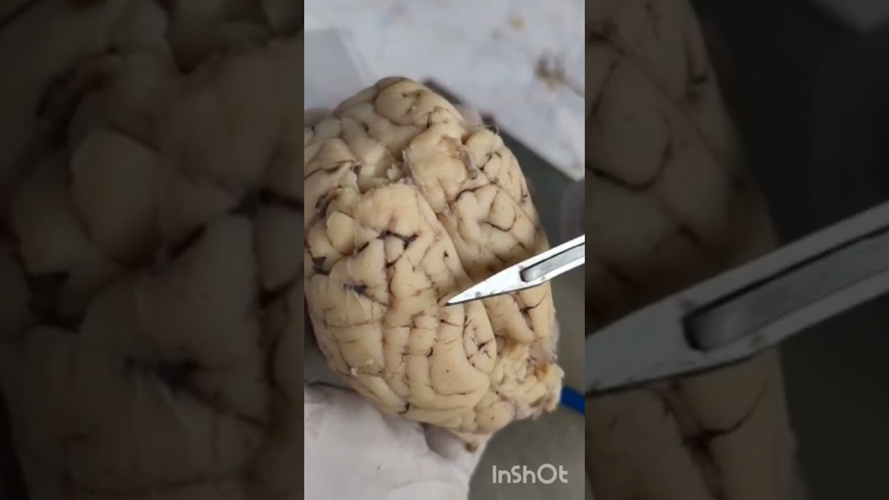 Mammalian Brain Dissection and explanation of Internal, External features, X class Biology.