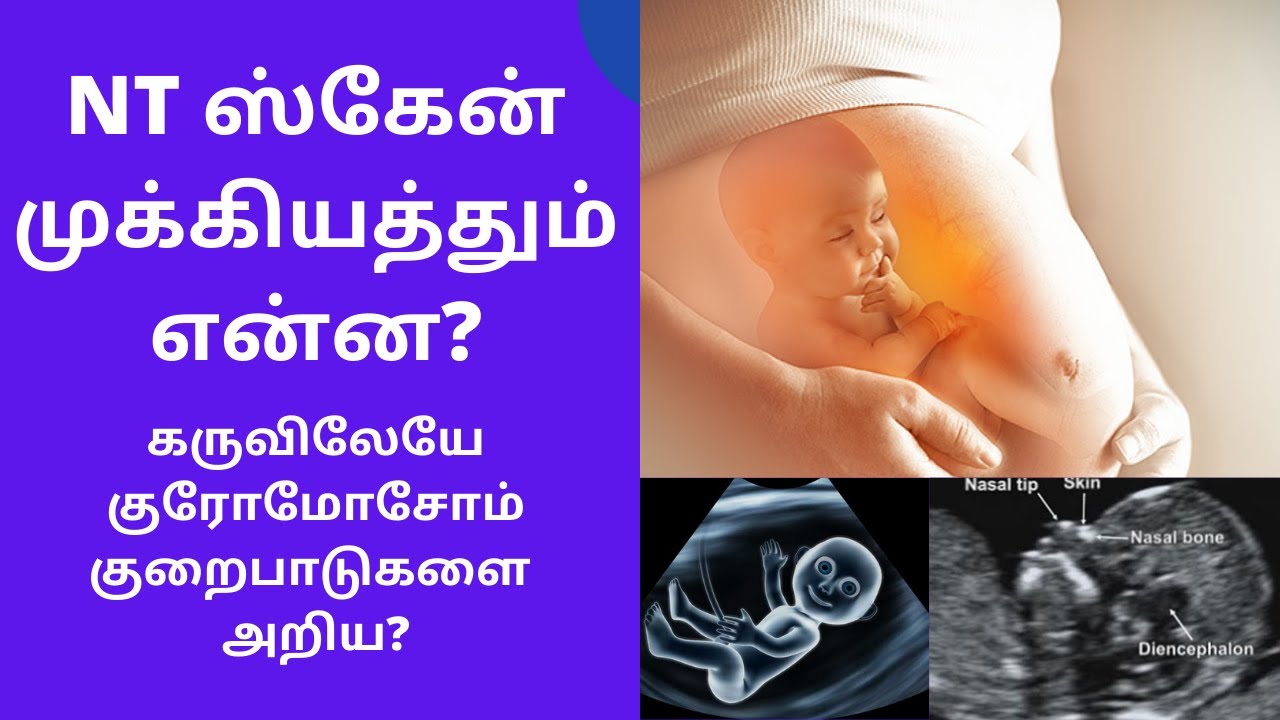 What Is NT Scan In Tamil Double Marker Test NT Scan NT Scan In 3 