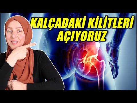 Video: Trokanterik bursit necə müalicə olunur?