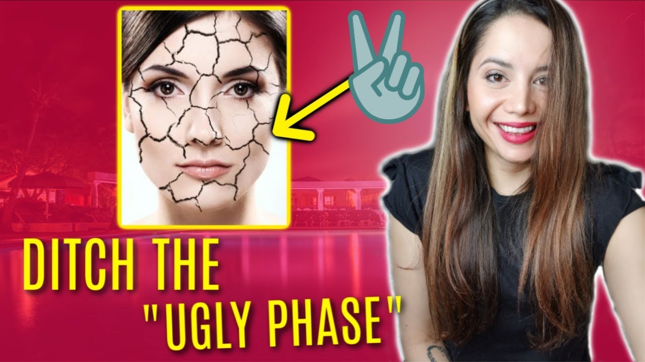 BEST Moisturizer For Retin A Dryness | *INSTANT RESULTS* - YouTube