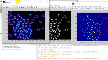 Triplet Markov Chain in Images Segmentation