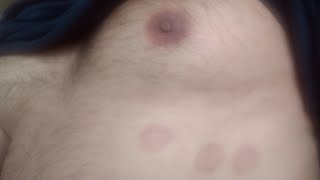 Roxas escuras pele linhas na