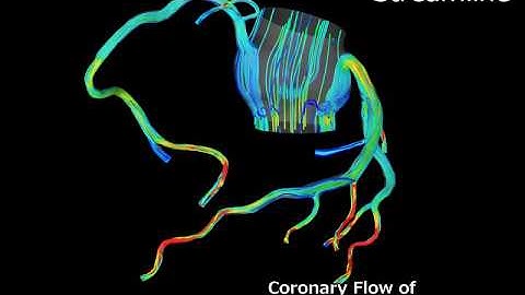 Coronary Artery Flow