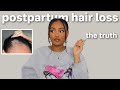 my postpartum hair loss ft. Vooglam