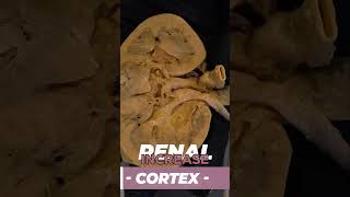 Download Lagu Caffeine Really Makes You Pee More? MP3 Download Lagu Caffeine Really Makes You Pee More? MP3