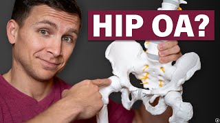 Doctor of Physical Therapy Answers Your 10 Most Common Questions About Hip Osteoarthritis