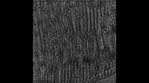 Onion cells, digital inline holography and reconstruction