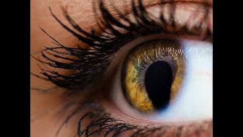 Zebrafish model helps explain eye development and sheds light on coloboma
