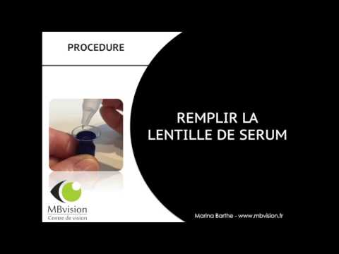 Vidéo: Comment insérer et retirer une lentille sclérale : 12 étapes (avec photos)