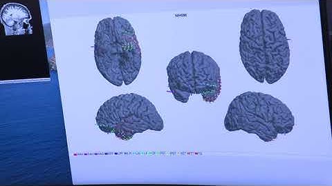 Recording neural activity and translating the “squiggles on the screen”