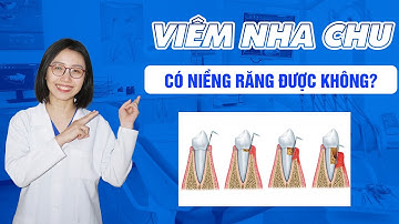 Viêm Nha Chu Rồi Có Niềng Răng Được Không? | Nam Bùi Vinalign
