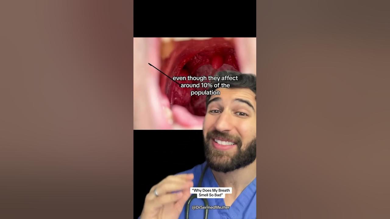 why-does-my-breath-smell-so-bad-this-youtube