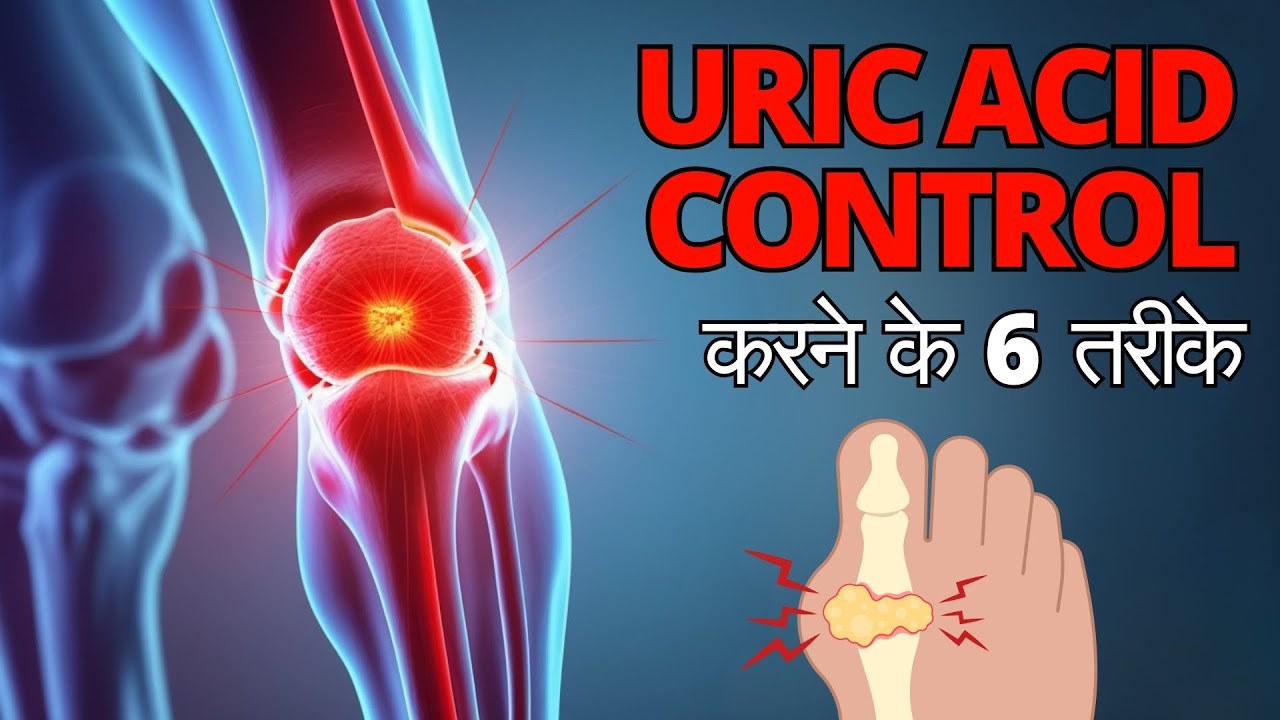 Uric Acid: Causes, Effects & Diet Myths | Dr. Uday Pote 