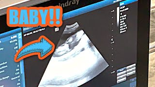 Pregnancy Confirmed!! ( So Excited! ) by James&MoVlogs 764 views 4 months ago 17 minutes