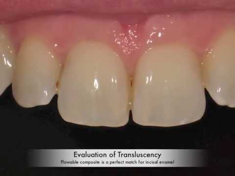 How do you restore tooth enamel?