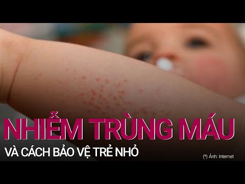 Cần làm gì để bảo vệ trẻ nhỏ trước nguy cơ nhiễm trùng máu? | VTC Now