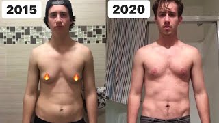 Top Surgery Timeline! (FTM)