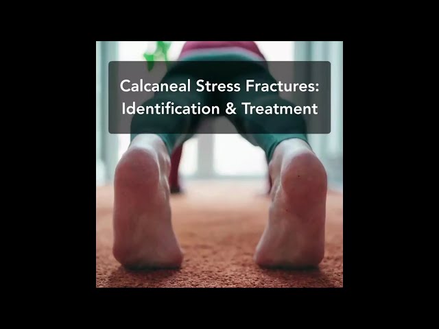 Stress Fracture of the Calcaneus - Everything You Need To Know - Dr. Nabil  Ebraheim - YouTube