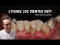 ¡Ya estás muy grande para usar brackets!