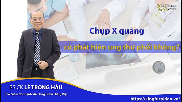 Chụp x quang phổi giá bao nhiêu