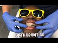 Braces Vlog |Changing BRACES #orthodontics #braces #teeth