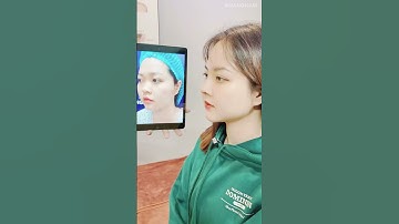 Nâng mũi cấu trúc Sline - Dáng mũi đẹp, khí chất lên