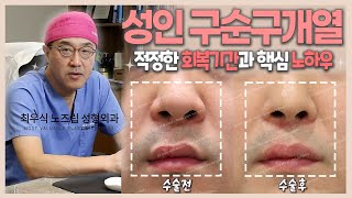 성인 구순구개열 수술 부위 적정한 회복 기간과 핵심 노하우