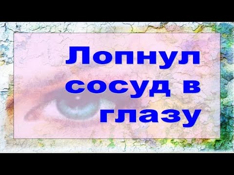 ❗️❗️❗️ Лопнул сосуд в глазу