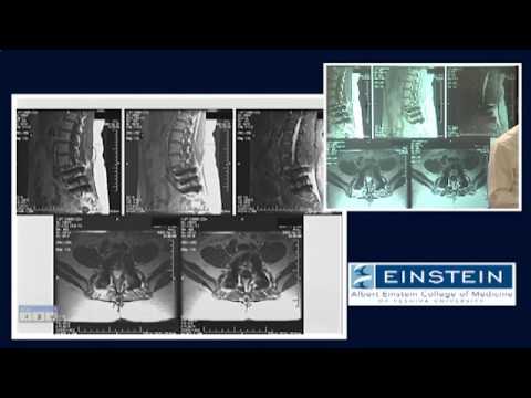 Introducing MRI: Artifacts (46 of 56)