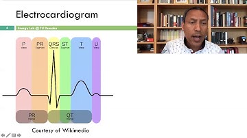 Application of Tensor Decomposition (Wireless Electrocardiogram): Dr. Waltenegus Dargie (TU Dresden)