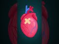Don't ignore frequent inflammation in your body. It may cause heart disease.